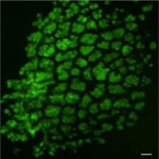 Bioinspired Gel Material May Hold Potential for Replacement of Damaged Organs