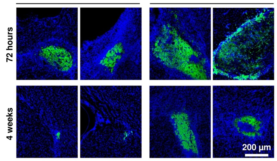 Advanced Biomaterial Holds Potential in Treating Damaged Brain Tissue