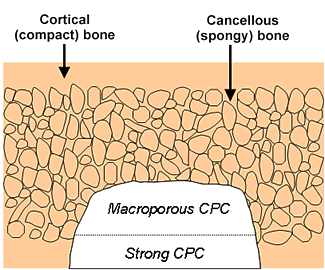 Layered Biomaterials May Make Strong Materials for Repair of Bones