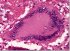 $2m Grant for Magnet Research to Combat Tuberculosis