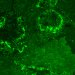 Biomolecule to Provide Information on the Condition of Bones and Teeth