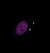 Size Does Matter in the Field of Medicine and Nanotechnology