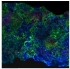 Bioengineers Create Artificial Bones with Skin Cells