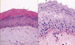 Tissue Engineers Commence Artificial Skin Production