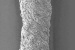 Biodegradable Nanofibre Fabric Could Help Athletes Reciver Quicker from Torn Tendons