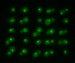 Laser Tweezers Help Scientists Study How Single Cells React to Stresses