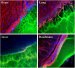 Surgical Adhesives Tailored to Specific Applications
