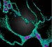 Implantable Materials that Change with Surrounding Tissues