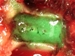HyperBranch Medical Achieves CE Mark for Adherus Spinal Sealant