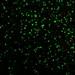 New Drug Delivery Technique Using Laser-Activated Carbon Nanoparticles