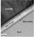 Researchers Figure Out Why DLC Hard Coatings Fail in Implant Applications