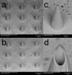 Scientists Develop New Plastic Microneedle for Skin Cancer Treatment