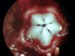 Nanocrystals Help in Self-Sharpening Mechanism of Sea Urchin’s Teeth