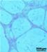 Researchers Analyze Application of Hydroxyapatite Ceramic Materials as a Biomaterial