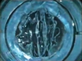 Researchers Develop Polymer Gel to Restore Normal Functioning of Vocal Cords