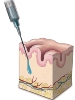 Facial Reconstruction to be Performed Using New Composite Material