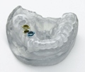 New Bio-Compatible Material Suitable for Dental and Medical Applications