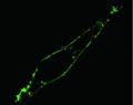 Researchers Develop Biocompatible Endoscope Using Tin Oxide Nanowires