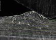 Swirling Fluid-like Behavior Observed In Sliding Metals