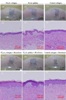 Hybrid Scaffold Material Holds Promise for Future Skin Tissue Engineering