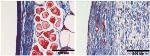 Non-Porous, Synthetic Biomaterial Holds Promise for Safe Medical Implants