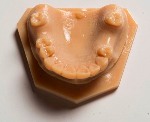 Stratasys' OrthoDesk 3D Printer, Digital Dentistry Solution Being Adopted Rapidly Worldwide