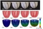 Low-Cost Soft Actuated Material Used to Replicate Biological Motion of the Heart