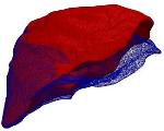 Real-Time Capable Computation Method Adapts Virtual Organ to Deformed Surface Profile
