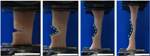 Researchers Observe Micro-Scale Mechanisms Behind Skin’s Resistance to Tearing
