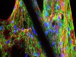 Hydrogels Reinforced with 3D Printed Microfiber Holds Promise for Joint Repair, Breast Reconstruction