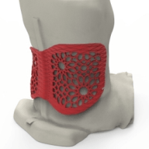 Latvian Wheelchair Fencer Uses Stratasys Customized 3D Printed Back Brace to Overcome Discomfort and Limited Movement