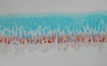Raman Spectroscopy Helps Researchers Compare Quality of Engineered Cartilage Material with Human Cartilage