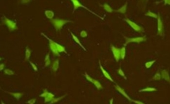 Researchers Develop New Technique to Improve Biocompatibility of Materials Used for Prosthesis
