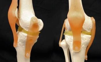 3D-Printable Hydrogel Implants Match Strength and Elasticity of Human Cartilage