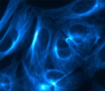 SRRF-Stream - Andor Launches the World’s First Super-Resolution Microscopy Camera