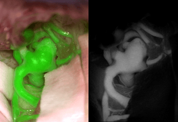 Augmented Reality Imaging Supports Clinical Decision-Making for Vascular Neurosurgeons