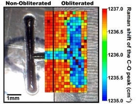 New Method to Recover Erased Serial Numbers in Polymers