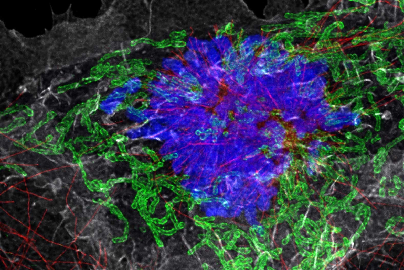 Redefining the detection limit of confocal imaging