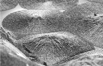 Remineralizing Dental Enamel