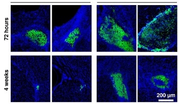 Advanced Biomaterial Holds Potential in Treating Damaged Brain Tissue