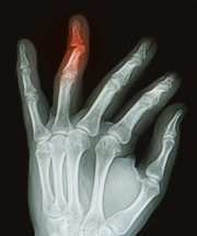 Researchers Create New Material that Talks to Surrounding Tissues to Promote Healing