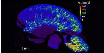 Rapid, All-Elemental Bioimaging with LA-icpTOF