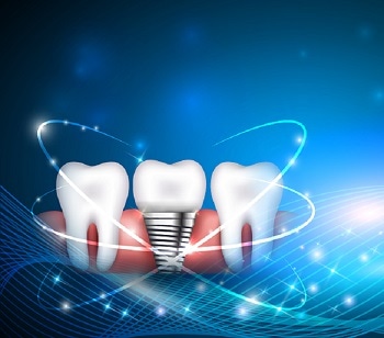 Using T-Scan Technology for Dental Medicine