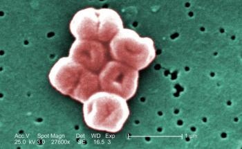 PACE Proteins in Bacteria Could be Used to Produce Next-Gen Plastics