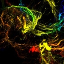 New Way to Produce Sticky Polymer Microparticles with Hierarchical Branching