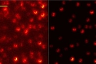New Coatings on Implants Could Help Make Them More Compatible
