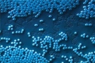 Gold Nanoparticles Illuminate Small Molecule Drugs in Cells