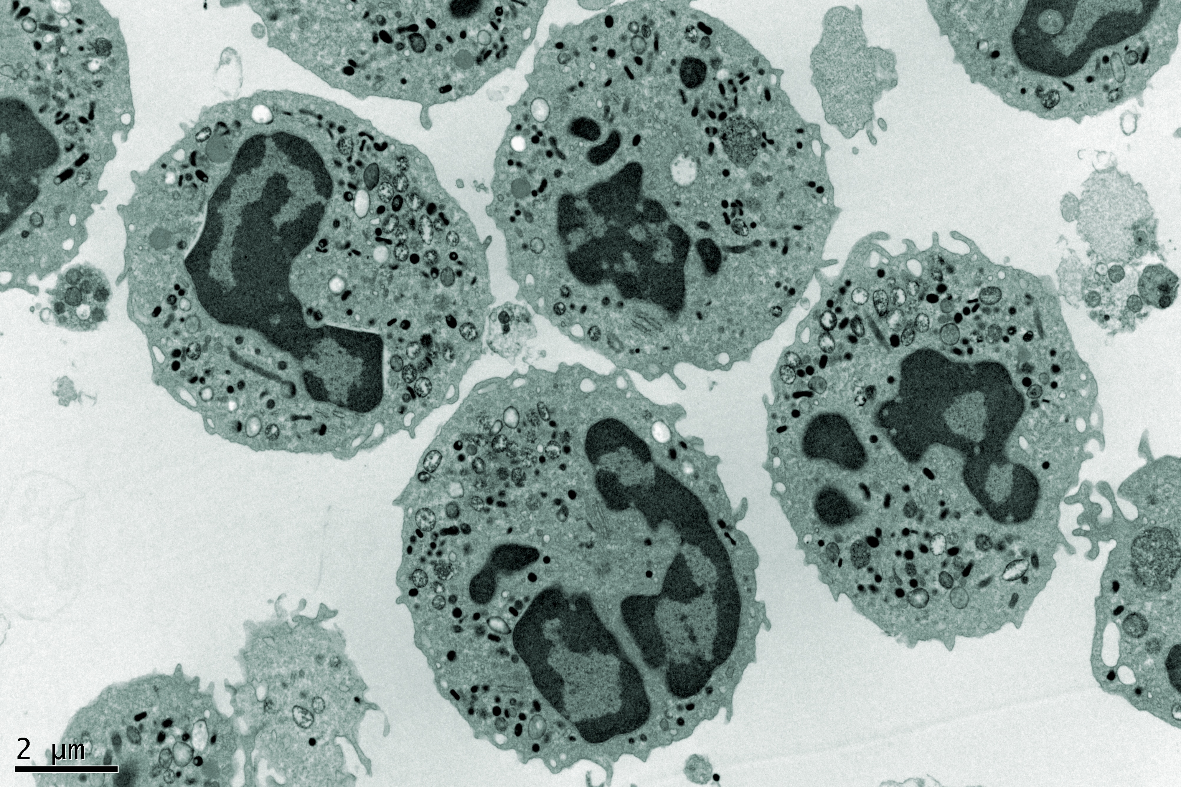Novel Method to Produce More Energy from Microalgae