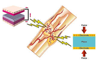 Using Bone’s Natural Electricity to Promote Regeneration