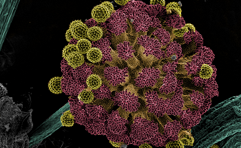 JEOL Announces 2020 Microscopy Image Grand Prize Winners